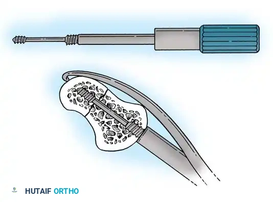 Hutaifortho's Orthopaedic Diagram