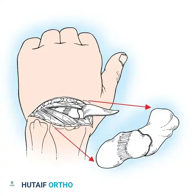 Hutaifortho's Orthopaedic Diagram