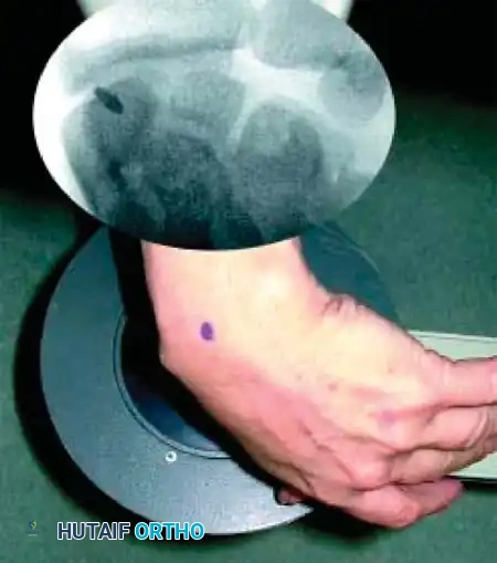 Hutaifortho's Orthopaedic Diagram