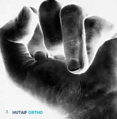 FRACTURES, DISLOCATIONS, AND LIGAMENTOUS INJURIES James H. Calandruccio Surgical Diagram