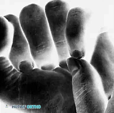 FRACTURES, DISLOCATIONS, AND LIGAMENTOUS INJURIES James H. Calandruccio Surgical Diagram