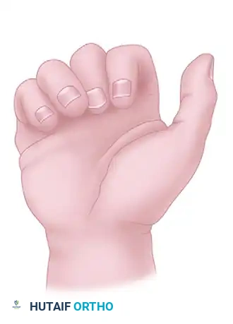 FRACTURES, DISLOCATIONS, AND LIGAMENTOUS INJURIES James H. Calandruccio Surgical Diagram