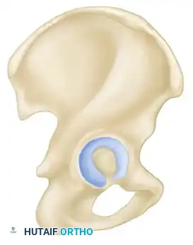 FRACTURES OF ACETABULUM AND PELVIS James L. Guyton • Edward A. Perez Surgical Diagram