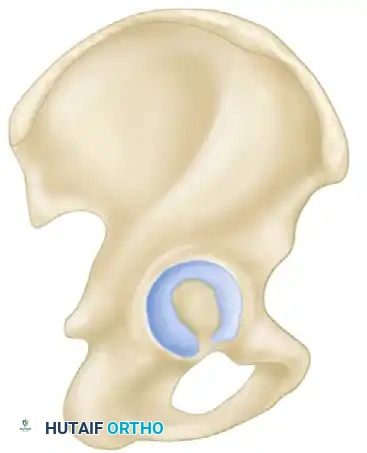 Dome of acetabulum