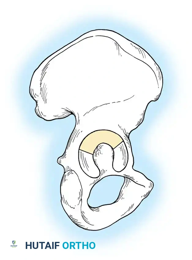 Dome of acetabulum