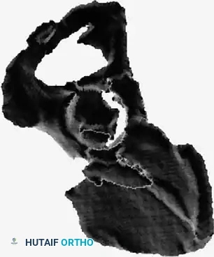 Hutaifortho's Orthopaedic Diagram