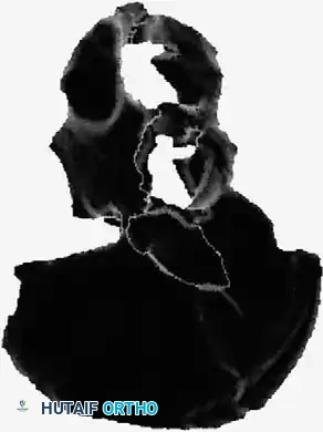 Hutaifortho's Orthopaedic Diagram