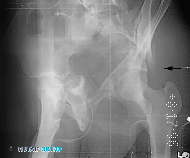 Hutaifortho's Orthopaedic Diagram