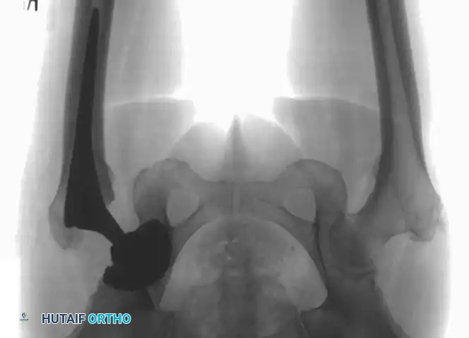 Hutaifortho's Orthopaedic Diagram