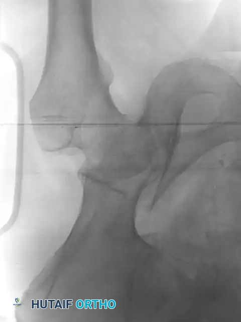 Hutaifortho's Orthopaedic Diagram