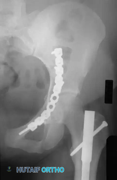 Hutaifortho's Orthopaedic Diagram