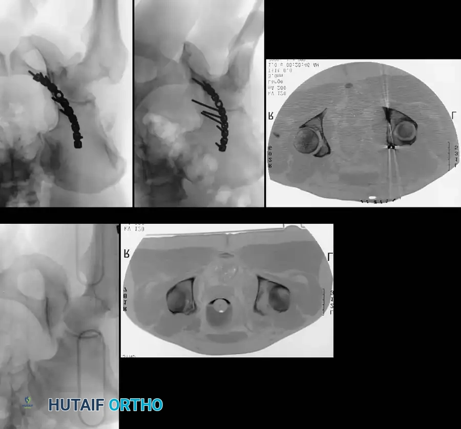 Hutaifortho's Orthopaedic Diagram