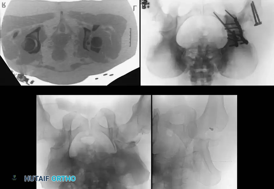 Hutaifortho's Orthopaedic Diagram