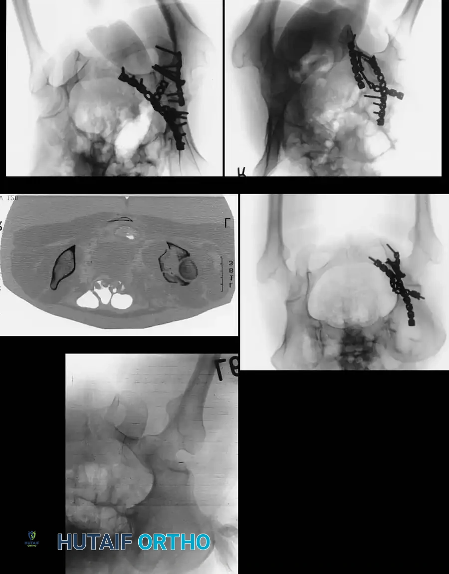 Hutaifortho's Orthopaedic Diagram