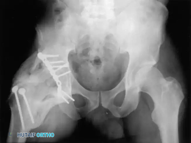 Hutaifortho's Orthopaedic Diagram