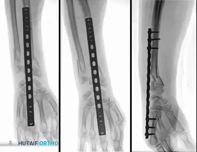 Hutaifortho's Orthopaedic Diagram