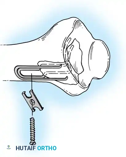 Hutaifortho's Orthopaedic Diagram