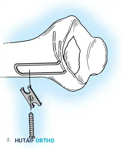 Hutaifortho's Orthopaedic Diagram