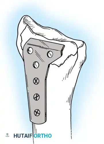 Hutaifortho's Orthopaedic Diagram