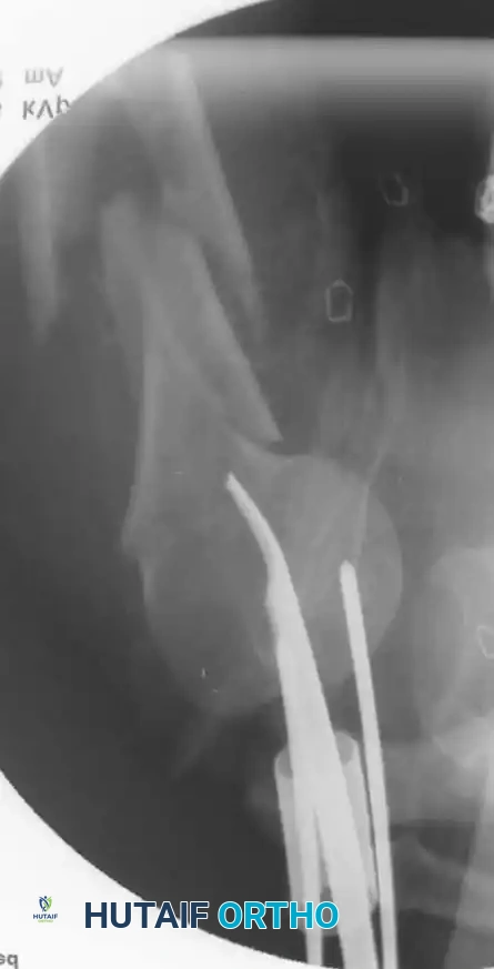 Hutaifortho's Orthopaedic Diagram