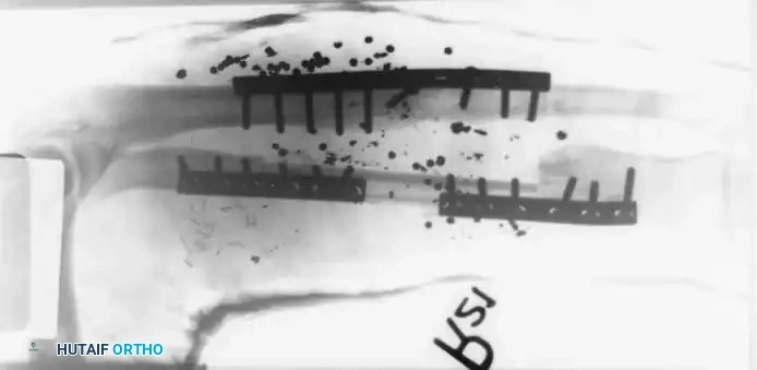 Recipient Site Preparation