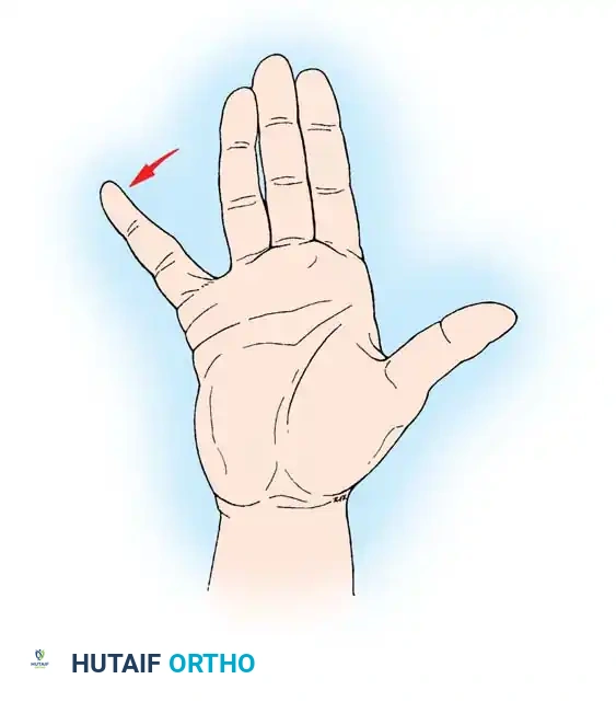 Clinical Evaluation and Surgical Management of Upper Extremity Peripheral Nerve Injuries