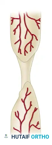 GENERAL TREATMENT OF NONUNIONS Surgical Diagram