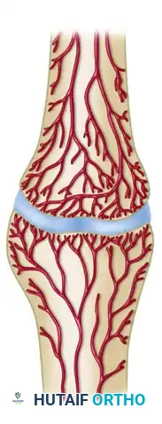 General Treatment of Nonunions: A Comprehensive Surgical Guide