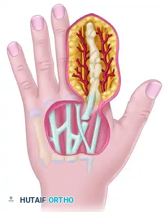 GRAFTS AND FLAPS Surgical Diagram