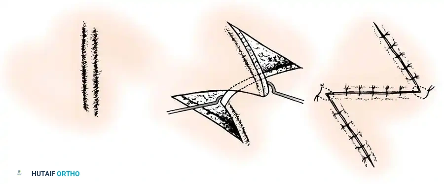 Hutaifortho's Orthopaedic Diagram
