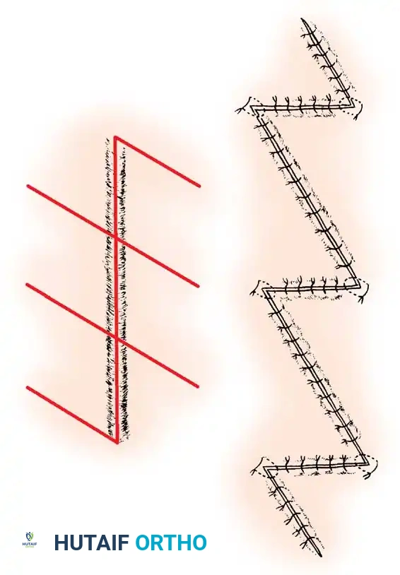 Hutaifortho's Orthopaedic Diagram