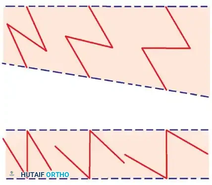 Hutaifortho's Orthopaedic Diagram