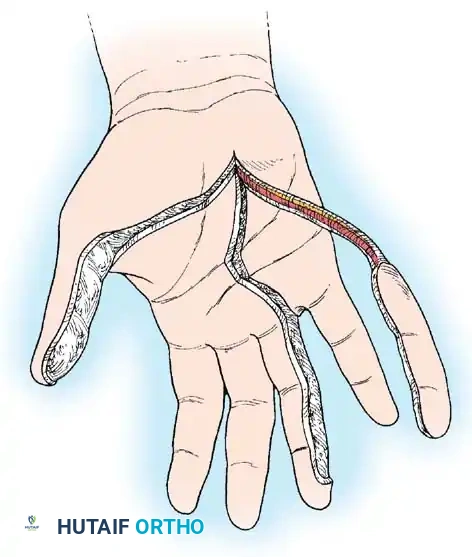 Hutaifortho's Orthopaedic Diagram