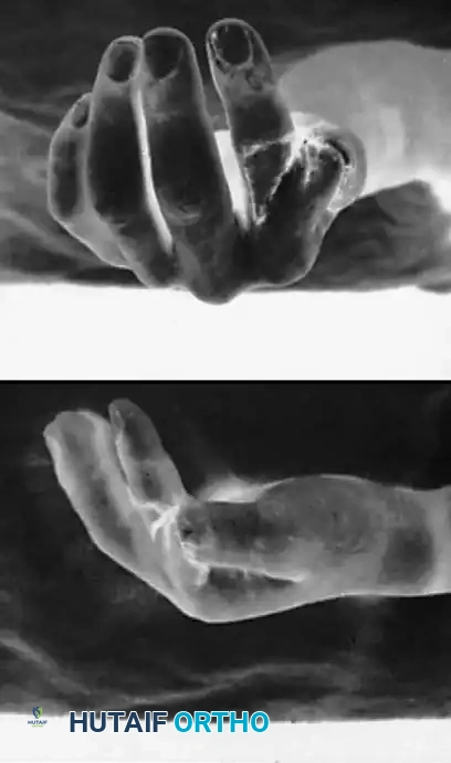 Hutaifortho's Orthopaedic Diagram