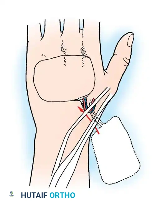 Hutaifortho's Orthopaedic Diagram