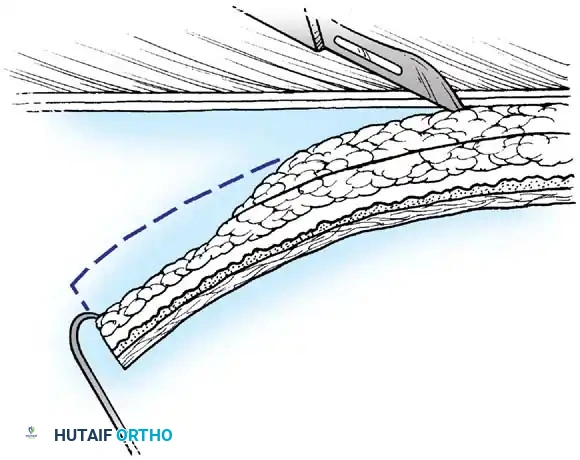 Hutaifortho's Orthopaedic Diagram