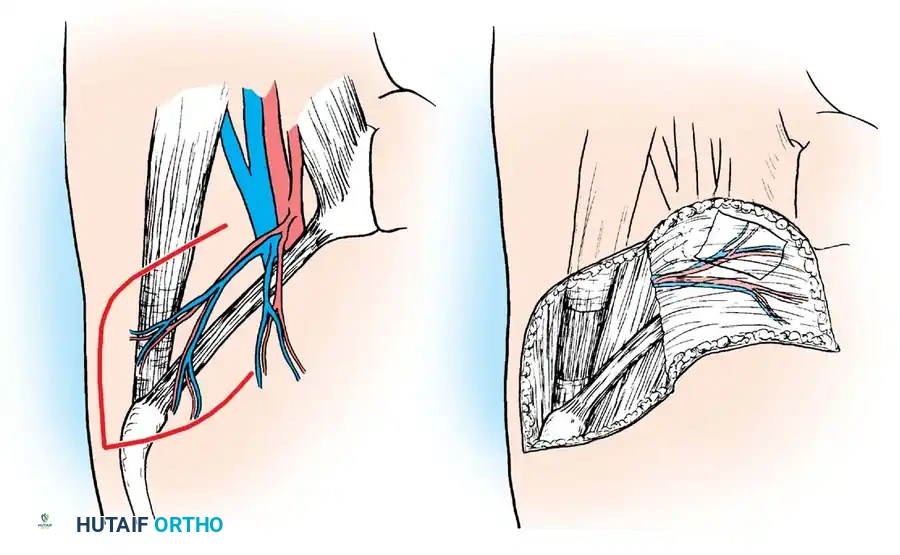 Hutaifortho's Orthopaedic Diagram