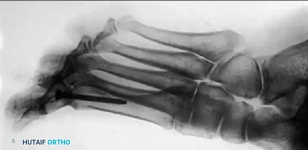 Hutaifortho's Orthopaedic Diagram