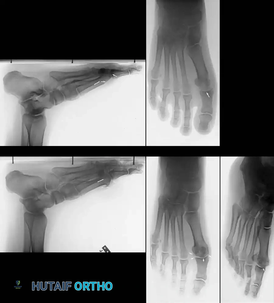 Hutaifortho's Orthopaedic Diagram