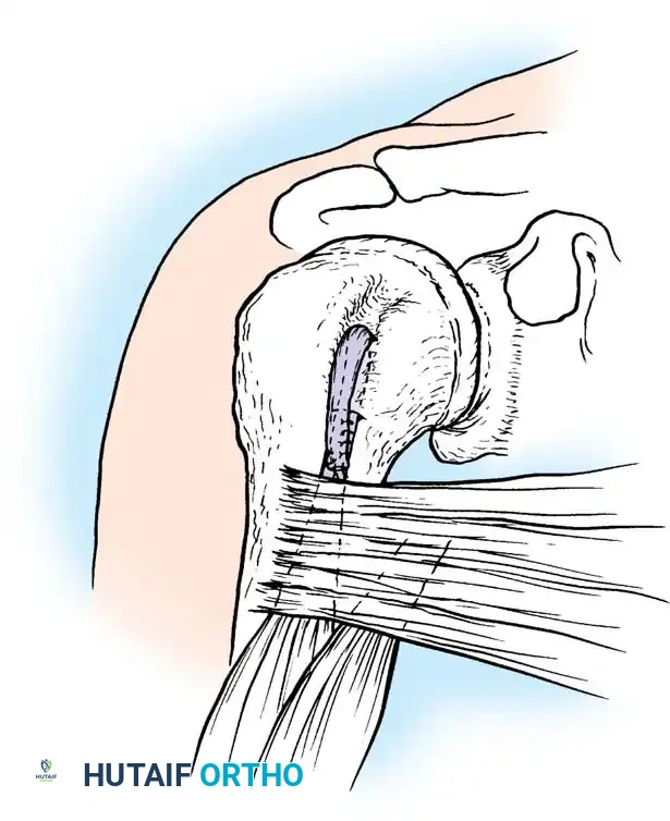 Hutaifortho's Orthopaedic Diagram