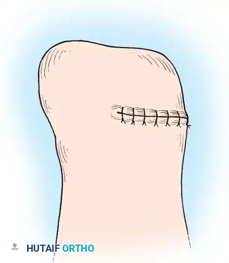 Hutaifortho's Orthopaedic Diagram