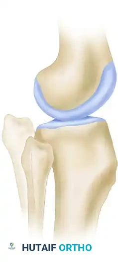 Hutaifortho's Orthopaedic Diagram