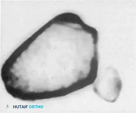 Hutaifortho's Orthopaedic Diagram
