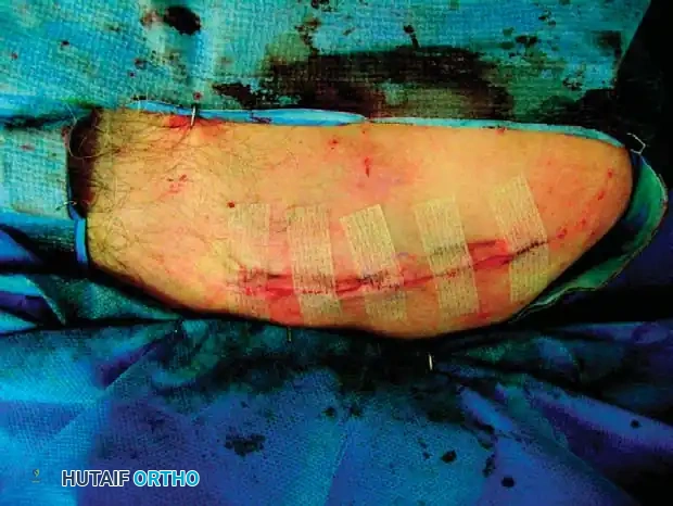 Hutaifortho's Orthopaedic Diagram