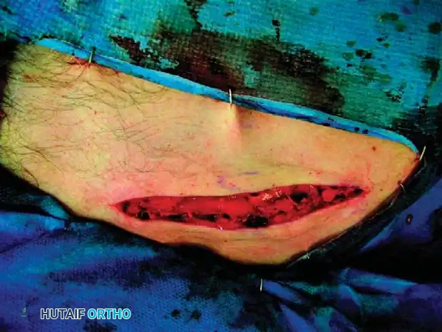 Hutaifortho's Orthopaedic Diagram