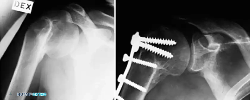 Hutaifortho's Orthopaedic Diagram