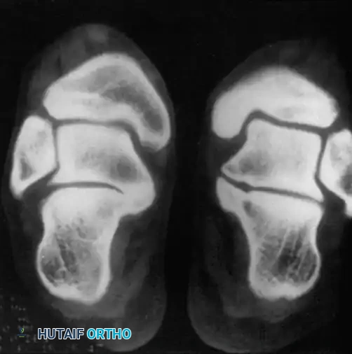 INTERNAL DERANGEMENTS Surgical Diagram