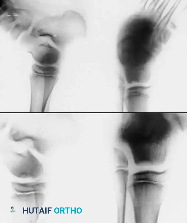 INTERNAL DERANGEMENTS Surgical Diagram