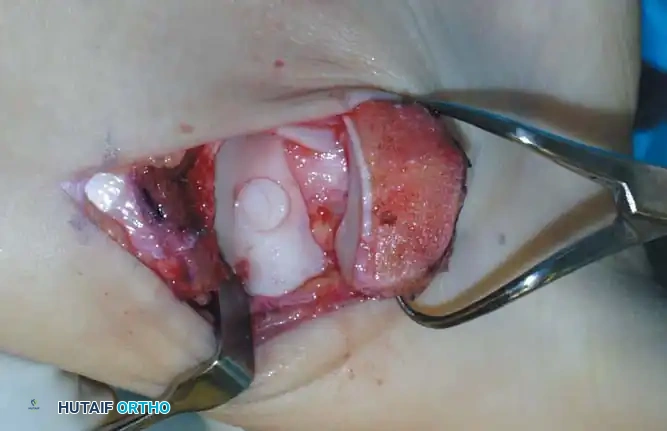 Hutaifortho's Orthopaedic Diagram