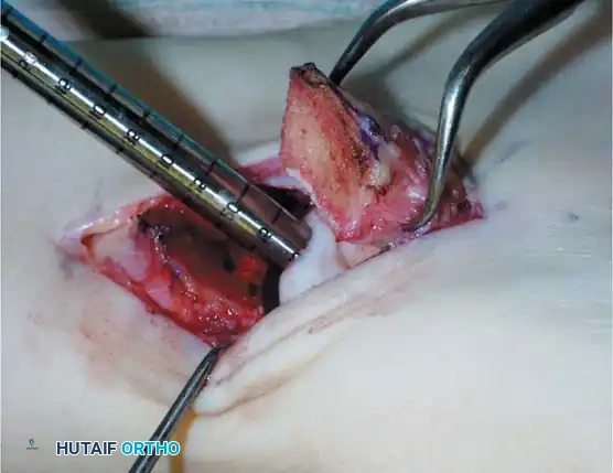 Hutaifortho's Orthopaedic Diagram